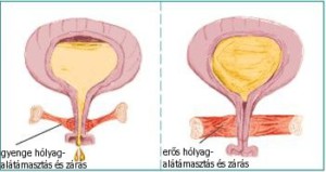 húgyhólyag anatómia, Intimtornához Biofeedback Gátizom tréner, enterococcus sp okozta húgyúti gyulladás, Escherichia coli baktériumok okozta fertőzés, inkontinencia, hólyaghurut,